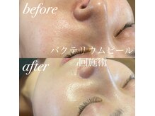 ココフルール(Cocofleur)の雰囲気（バクテリウムピールで定期的に栄養補給♪）