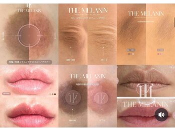 シンデレラ(Cinderella)