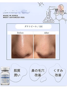 肌イズム 守谷店(肌ism)/【before&after】ダクトピール