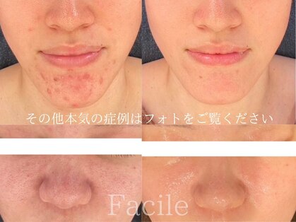 ファシル(Facile)の写真
