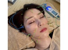 大矢野鍼灸サロンの雰囲気（見た目年齢が変わる美容鍼＊心もお肌も明るく健康に…。）