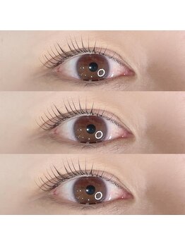 オルト(ORT)/ラッシュリフト