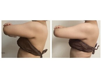 プリズミント(Prismint)/脂肪燃焼パック