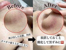 トゥウィーサロン 梅田(Tweesalon)/韓国美容/白玉肌管理