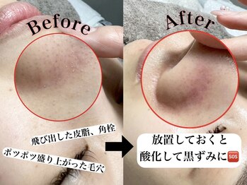 トゥウィーサロン 梅田(Tweesalon)/韓国美容/白玉肌管理
