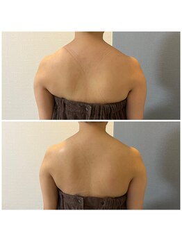 モア(moa)/症例写真