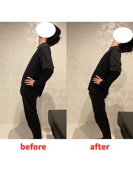 ナオル整体 福岡香椎院(NAORU整体)/30代男性施術事例【腰の痛み】