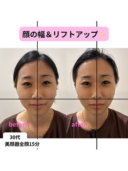 ベルソー鍼灸整体院(berceau鍼灸整体院)/