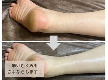 ラベル(RABEL)の雰囲気（夕方になるとだるくなる足もむくみがとれるとすっきり★）