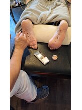 ほぐし堂/知熱灸3