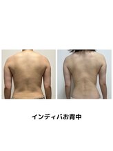 オンケイ(Onkei)/継続施術でこんなにスッキリ！