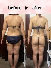 ユルリ 水戸本店(yururi)/腰回り、太ももサイズダウン！！