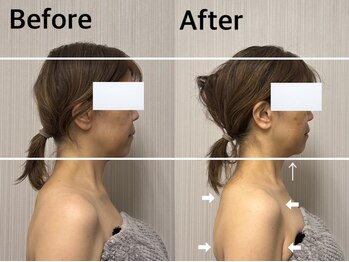 ベール(BEHL)/コルギのBefore After