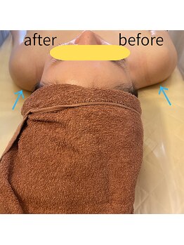 アリア(alia)/その日のうちに見た目－５キロ