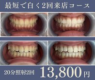 グリッター ショウナン(glitter. SHONAN)