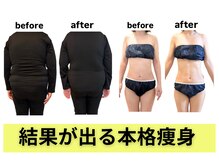 ヨサパーク ムーン(YOSA PARK Moon)