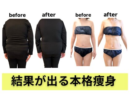 ヨサパーク ムーン(YOSA PARK Moon)の写真