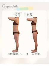 ジプソフィラ(Gypsophila)/痩身ビフォーアフター