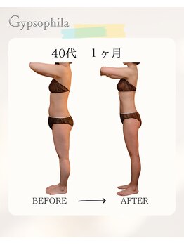 ジプソフィラ(Gypsophila)/痩身ビフォーアフター