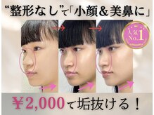 ラプリ 盛岡店(Raplit)/隆鼻＋輪郭矯正40分30回