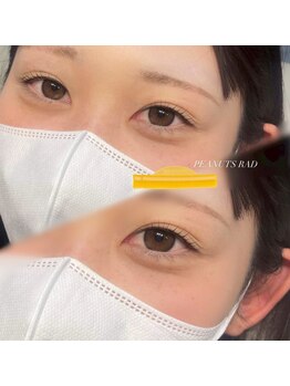 ビオラス 天王寺2号店(Biolus)/まつげパーマ/ラッシュリフト