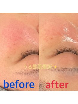 ソアン(Soin)/韓国肌管理でうる艶肌爆誕