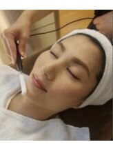 ダーマルラボ 福島店/イオン導入