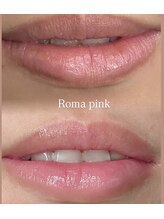 Kino Beauty Salon二子玉川店 ローマピンク/ホワイトラボ/脂肪冷却/シミ/メラニンケア/ローマピンク【唇/リップ】