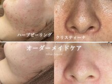 ミハン ボーテ(mihan.beaute)