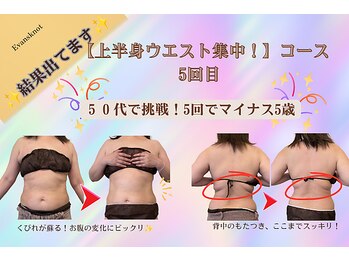 エバンス ノット(Evans knot)の写真/【色々試したあなたへ!】痛い痩身はもうコリゴリ★プロの痩身技術で自分史上最高の美BODYへ!