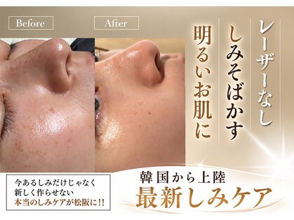 マヌレニ(manuleni)の写真