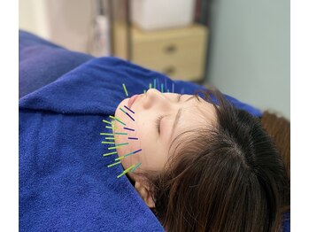 プロムナード(PROMENADE)/肌集中ケア美容鍼