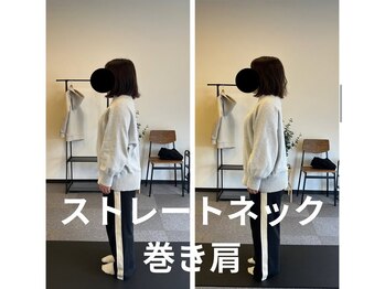 カワル整体 長嶺院/ストレートネック&巻き肩