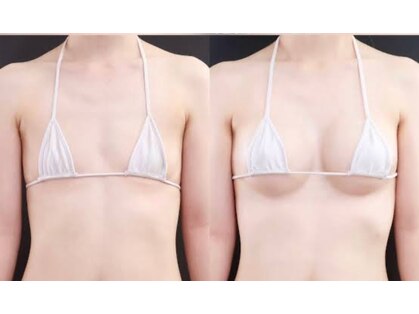 ティアラ(Tiara)の写真