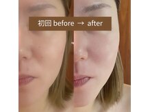 ラフォクシー(La.Foxy)