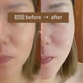 ラフォクシー(La.Foxy)