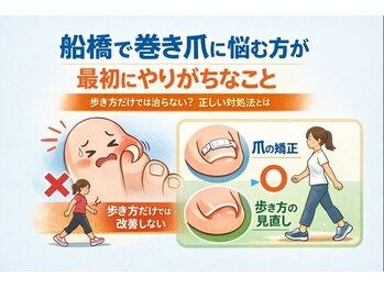 巻き爪じゅん 船橋店/歩き方だけで巻き爪は改善する？