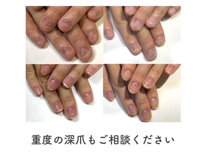 ネイルサロン プロムナード(nailsalon promnade)の写真