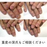 ネイルサロン プロムナード(nailsalon promnade)