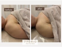 セブンフォリオ(7FORIO)/疲れたお肌のメンテナンスに