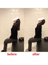 ナオル整体 福岡香椎院(NAORU整体)/20代女性施術事例【肩こり】