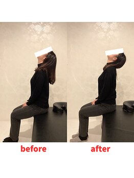 ナオル整体 福岡香椎院(NAORU整体)/20代女性施術事例【肩こり】