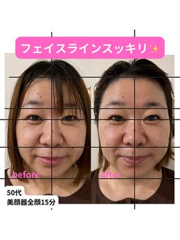 ベルソー鍼灸整体院(berceau鍼灸整体院)/