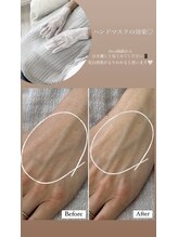 シーオングル(Siii ongle)/フットをしながらハンドマスク