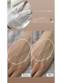 シーオングル(Siii ongle)/フットをしながらハンドマスク