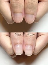 マリーロール 天王寺店(Marie Laure)/深爪矯正/自爪育成/ネイルケア/