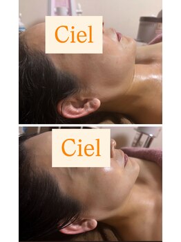 シエルグロウ(CielGrow)/背中からの小顔深層筋マッサージ