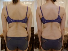 アンドボディ 横浜元町(&Body)/20代前半 &nbsp;痩身エステ