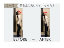 整体院 欅/整体効果　首の可動域