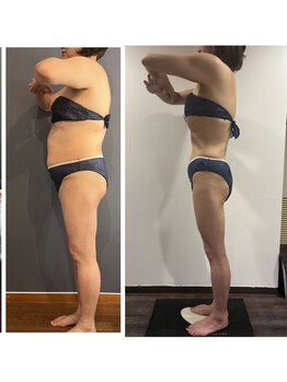 アミナス(Total Beauty Salon AMINAS)/ダイエットならお任せ♪